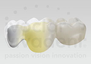crown_2 Crown