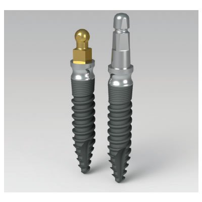 implant_1 Implant