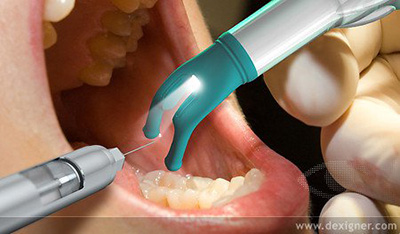 painless_injections Painless Injections