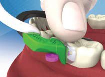 posterior_composite Posterior Composite